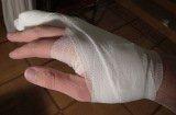 kaputt finger